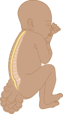 Congenital Malignancies